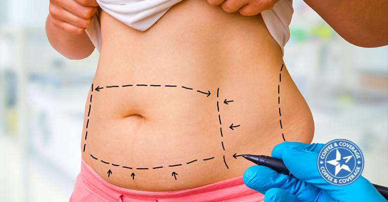 Is Liposuction Covered By Medicare?