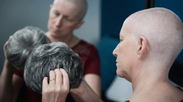 Does Medicare Cover Wigs For Cancer Patients?