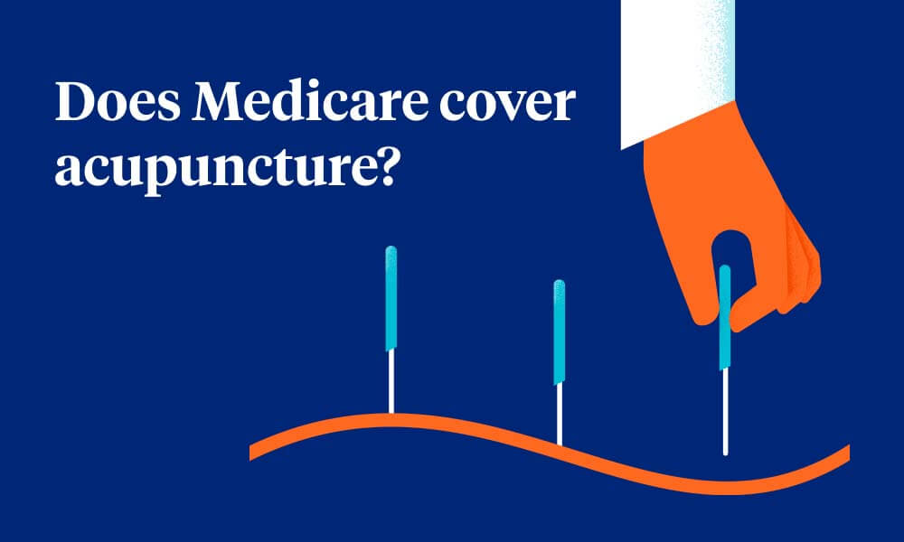 Does Medicare Cover Accupuncture?