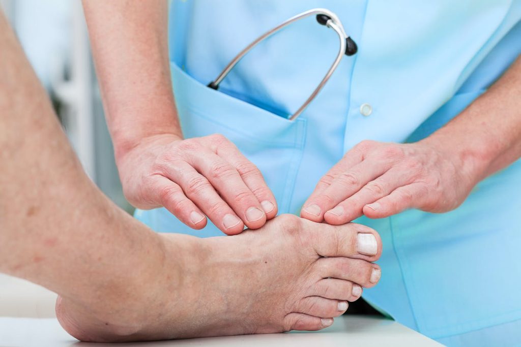 does medicare cover bunion surgery