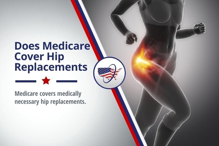 Does Medicare Cover Total Hip Replacement?