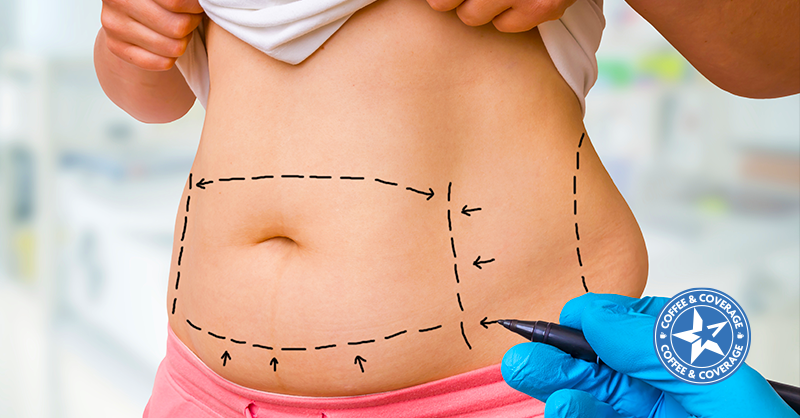 Is Liposuction Covered by Medicare?